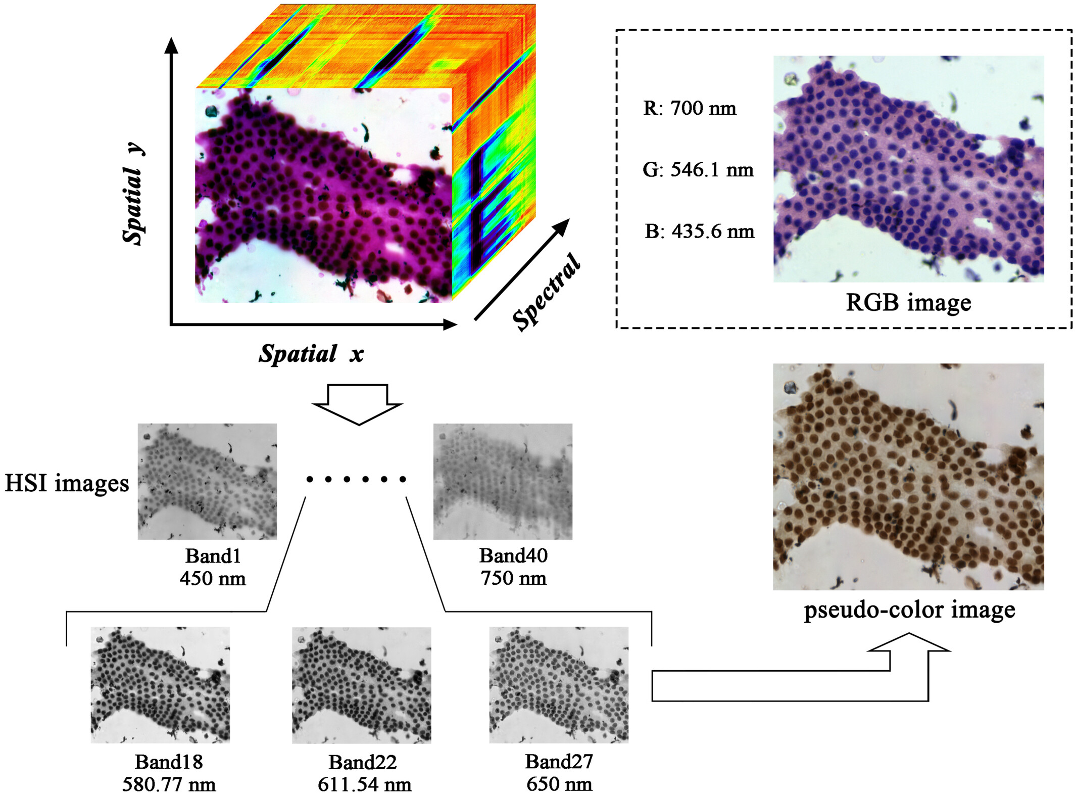 A deep learning model using hyperspectral image for EUS-FNA cytology diagnosis in pancreatic ductal adenocarcinoma
