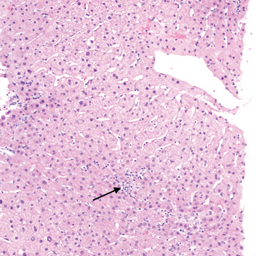 Details are in the caption following the image