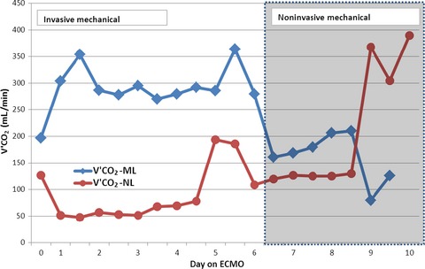 A case of veno-venous extracorporeal membrane oxygenation for severe respiratory failure in a superobese patient