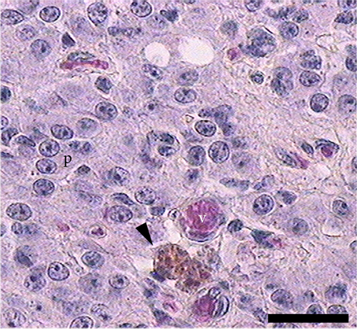 Details are in the caption following the image