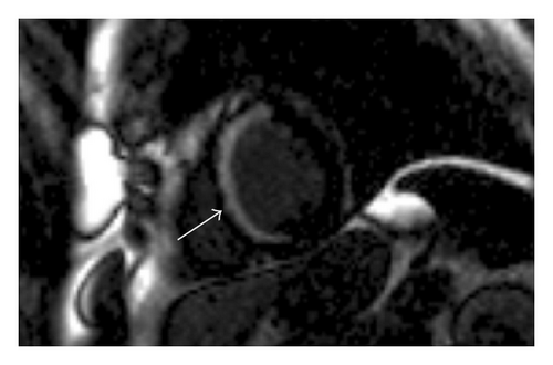Details are in the caption following the image