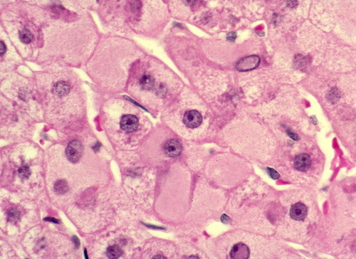 Details are in the caption following the image