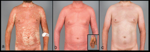 Details are in the caption following the image Details are in the caption following the image