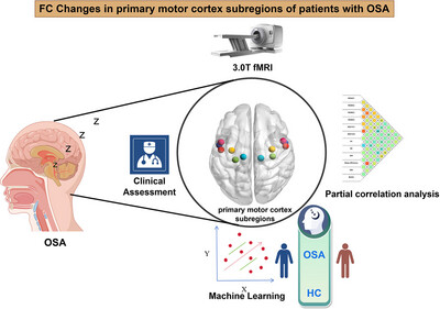 Functional Connectivity Changes in Primary Motor Cortex Subregions of Patients With Obstructive Sleep Apnea