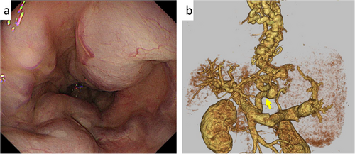 Details are in the caption following the image Details are in the caption following the image