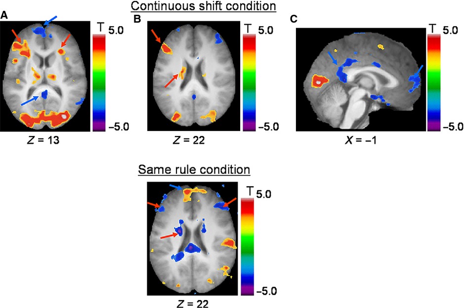 Exploration of the dynamics between brain regions associated with the default-mode network and frontostriatal pathway with regards to task familiarity
