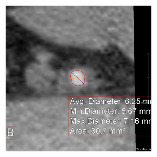 Details are in the caption following the image Details are in the caption following the image
