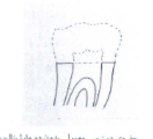 Details are in the caption following the image