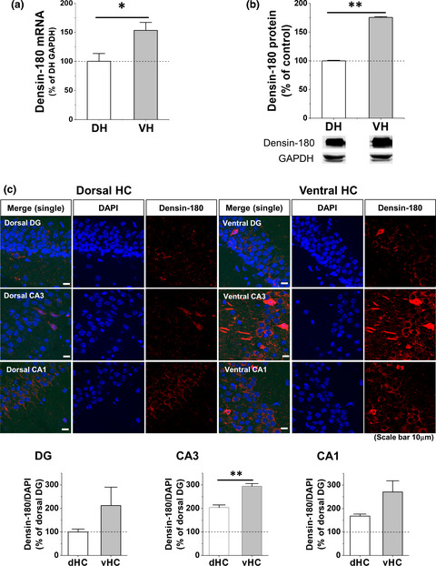 Role of densin-180 in mouse ventral hippocampal neurons in 24-hr retention of contextual fear conditioning