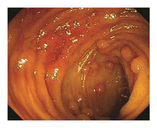 Details are in the caption following the image Details are in the caption following the image