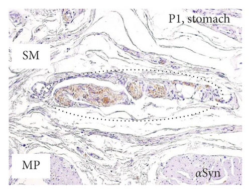 Details are in the caption following the image