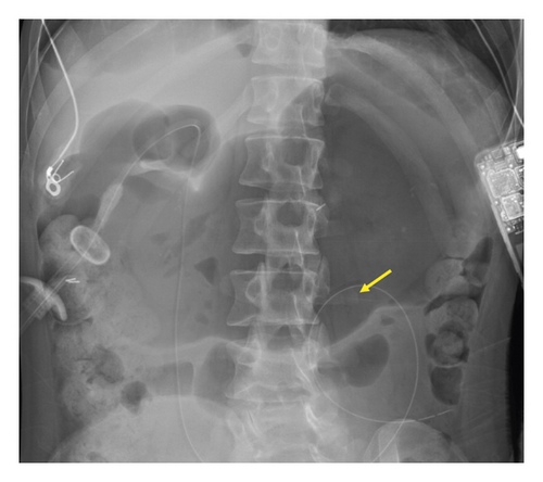 Details are in the caption following the image Details are in the caption following the image