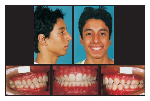 Details are in the caption following the image Details are in the caption following the image