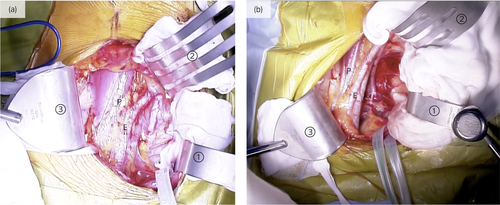 Details are in the caption following the image Details are in the caption following the image