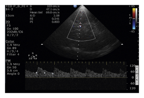 Details are in the caption following the image Details are in the caption following the image