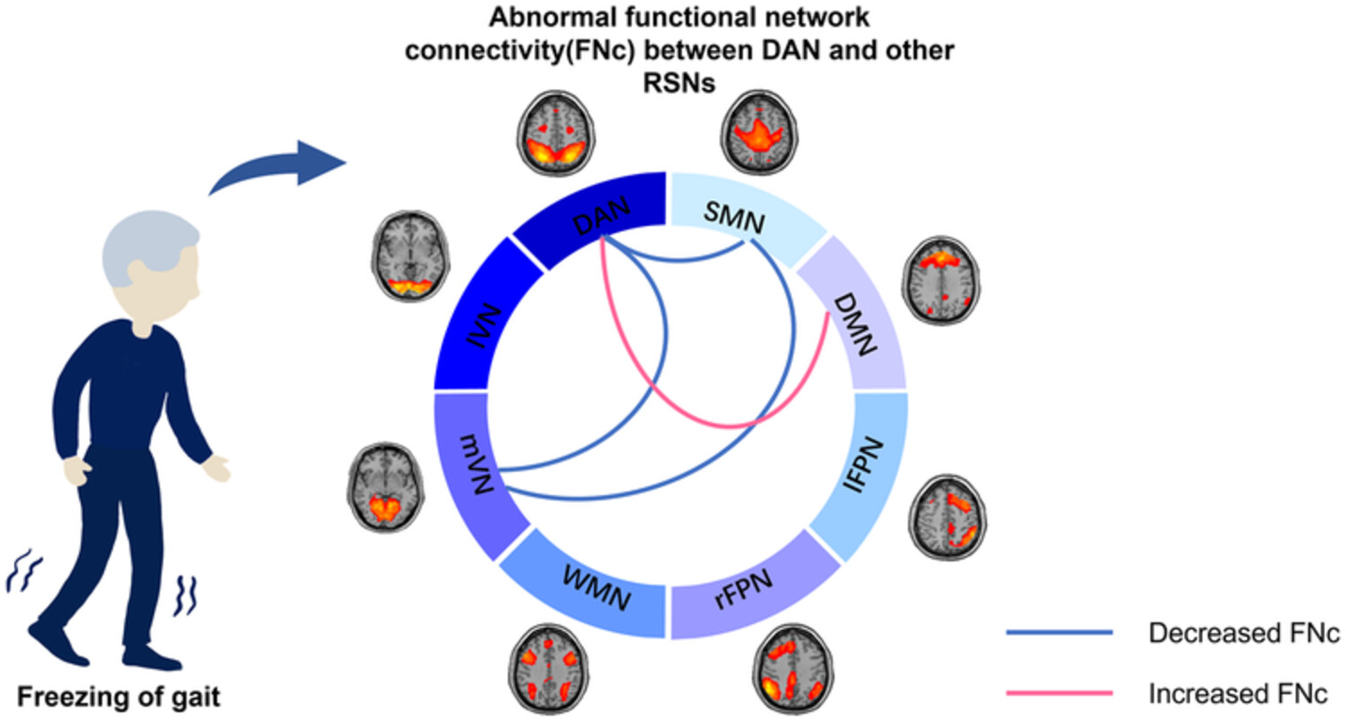 Disorganized resting-state functional connectivity between the dorsal attention network and intrinsic networks in Parkinson's disease with freezing of gait