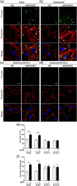 The P2Y6 receptor signals through Gαq/Ca2+/PKCα and Gα13/ROCK pathways to drive the formation of membrane protrusions and dictate cell migration