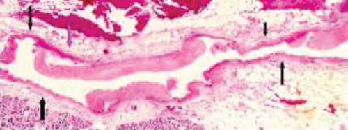 Details are in the caption following the image