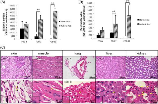 The infection characteristics and autophagy defect of dermal macrophages in STZ-induced diabetic rats skin wound Staphylococcus aureus infection model