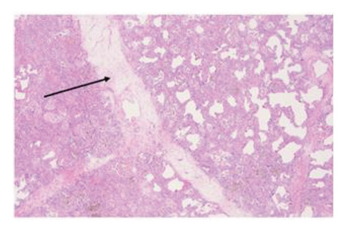Details are in the caption following the image