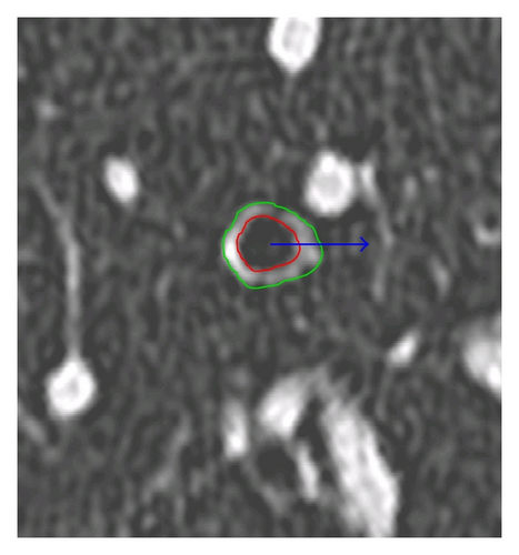 Details are in the caption following the image Details are in the caption following the image