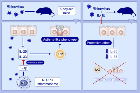 IL-1β prevents ILC2 expansion, type 2 cytokine secretion, and mucus metaplasia in response to early-life rhinovirus infection in mice