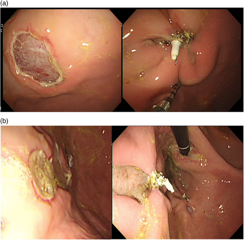 Details are in the caption following the image Details are in the caption following the image