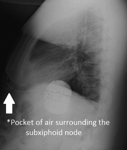 Details are in the caption following the image