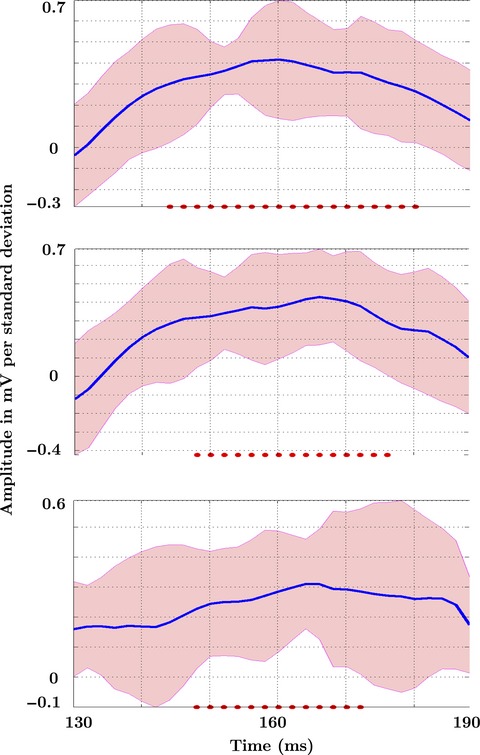 Strategic down-regulation of attentional resources as a mechanism of proactive response inhibition