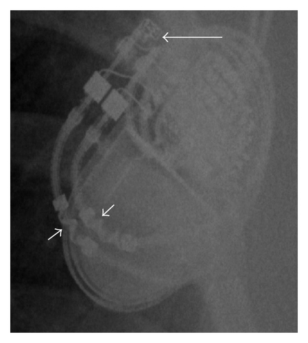 Details are in the caption following the image