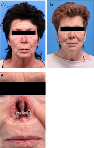 Details are in the caption following the image Details are in the caption following the image