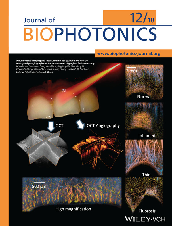 Inside Cover: A noninvasive imaging and measurement using optical coherence tomography angiography for the assessment of gingiva: An in vivo study (J. Biophotonics 12/2018)