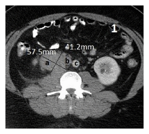 Details are in the caption following the image Details are in the caption following the image