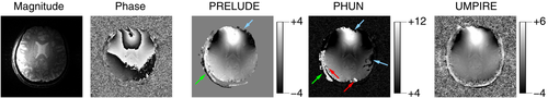 Details are in the caption following the image Details are in the caption following the image