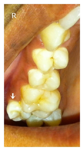 Details are in the caption following the image