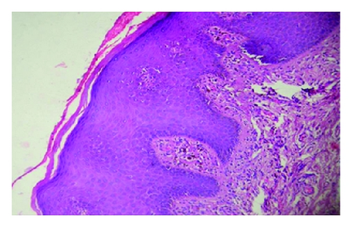 Details are in the caption following the image