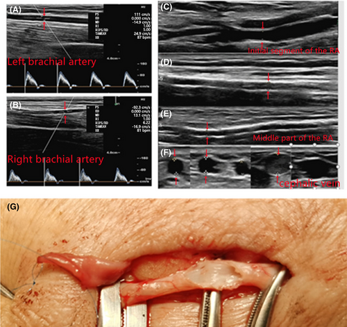 Details are in the caption following the image Details are in the caption following the image