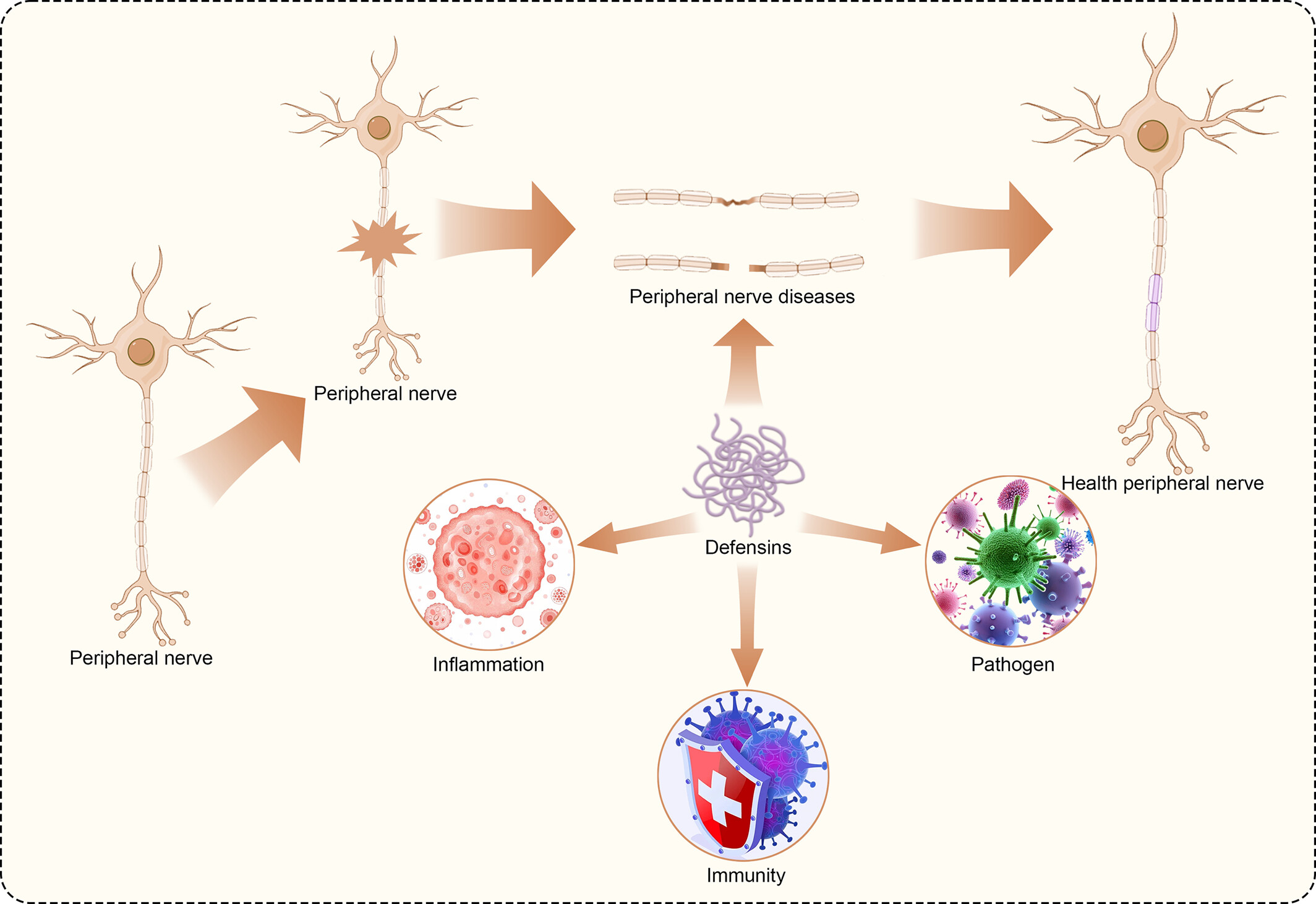 Defensin: The immune system regulatory factor against peripheral nerve disease