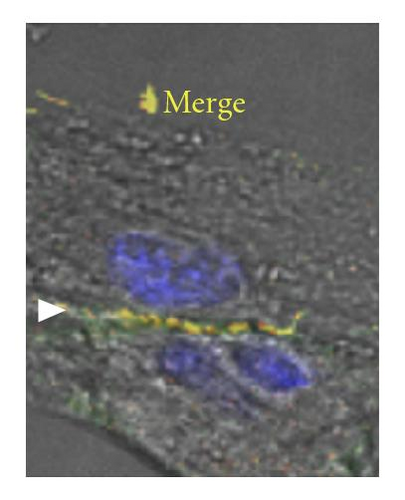 Details are in the caption following the image