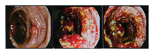 Details are in the caption following the image Details are in the caption following the image