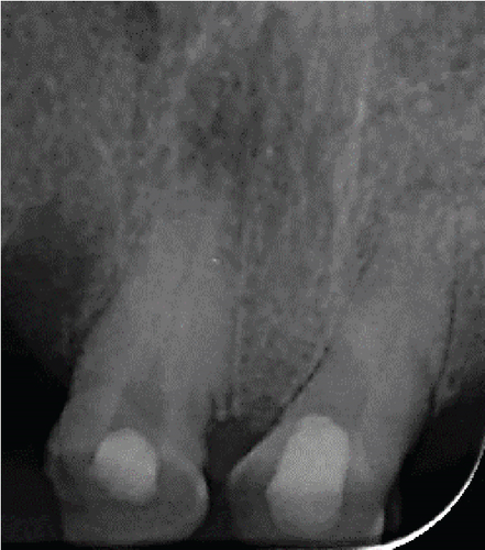Details are in the caption following the image