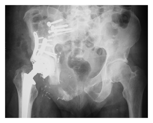 Details are in the caption following the image Details are in the caption following the image