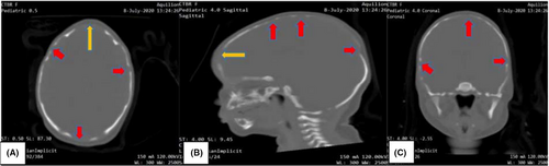 Details are in the caption following the image