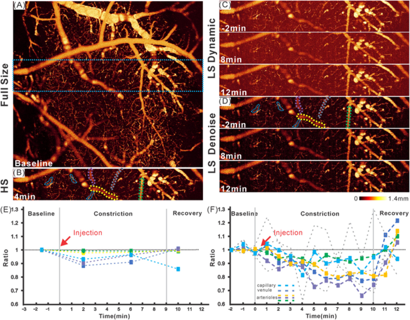 A deep-learning-based approach for noise reduction in high-speed optical coherence Doppler tomography