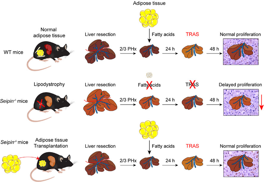 Adipose tissue deficiency impairs transient lipid accumulation and delays liver regeneration following partial hepatectomy in male Seipin knockout mice