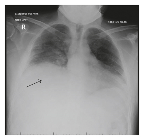 Details are in the caption following the image