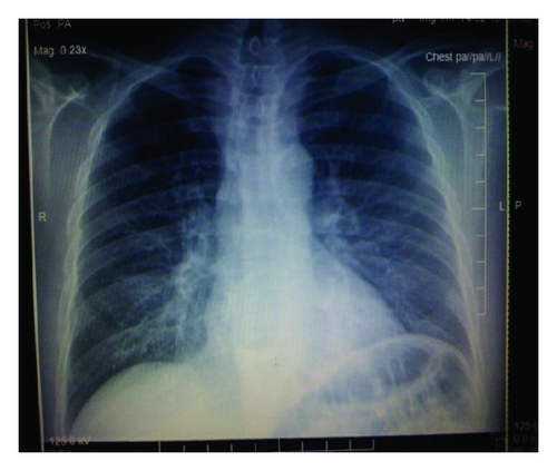 Details are in the caption following the image