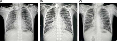 Details are in the caption following the image