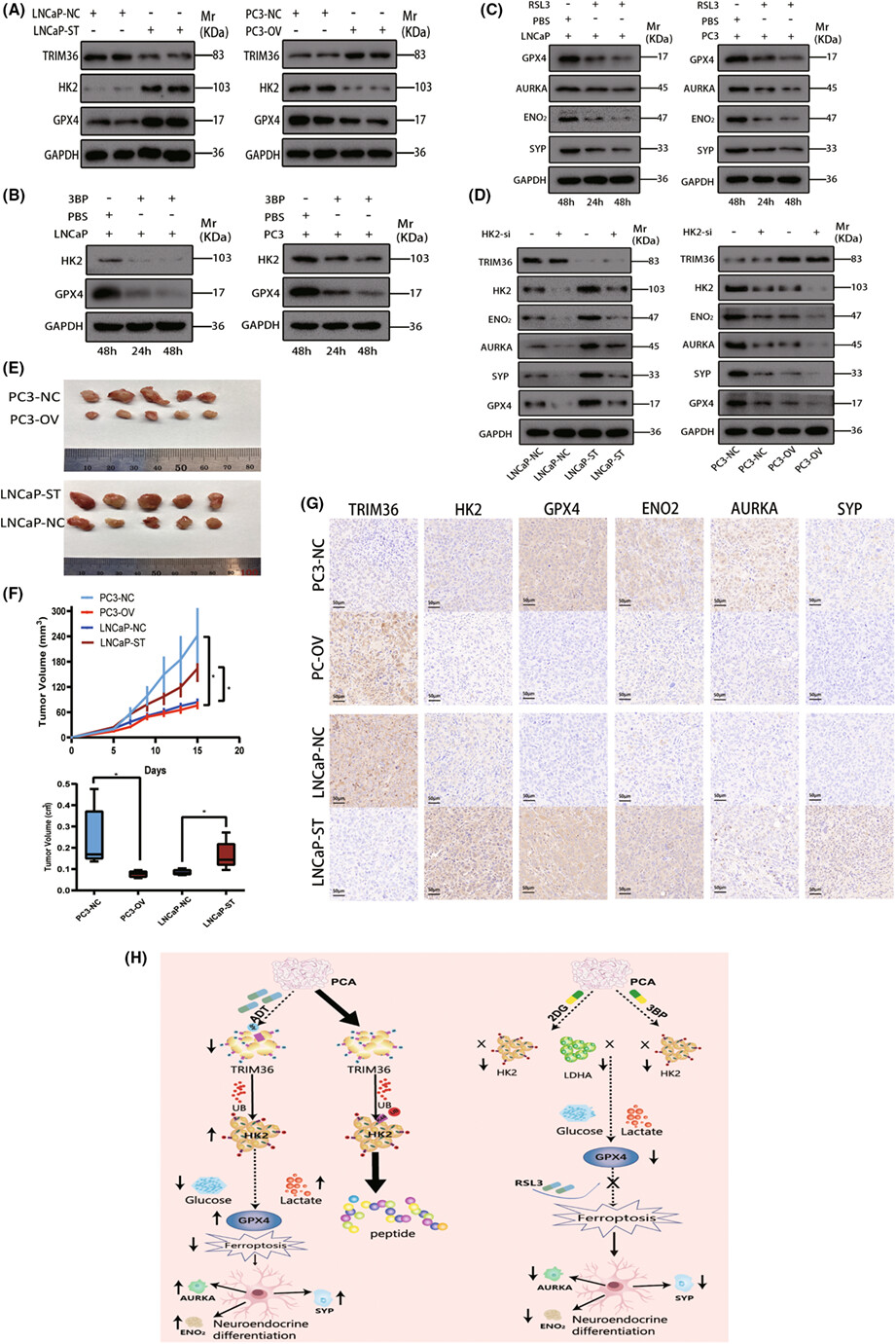Trigred motif 36 regulates neuroendocrine differentiation of prostate cancer via HK2 ubiquitination and GPx4 deficiency