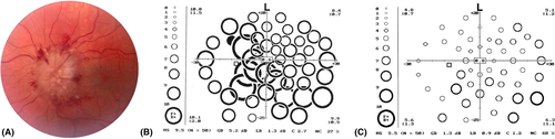 Details are in the caption following the image Details are in the caption following the image